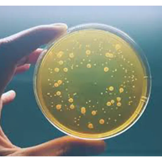 culture aerobic bacterial test